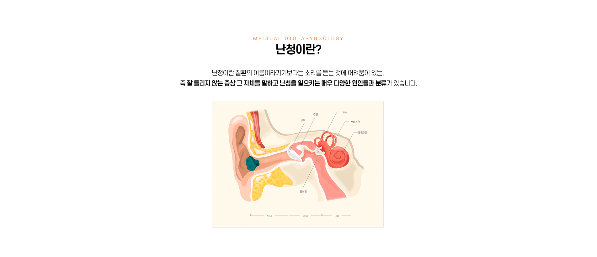 난청이란란?