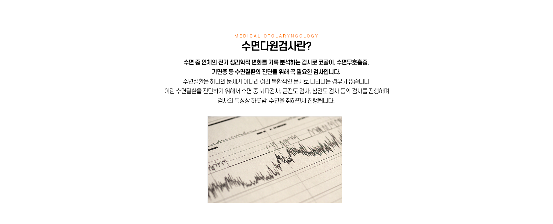 수면다원란?