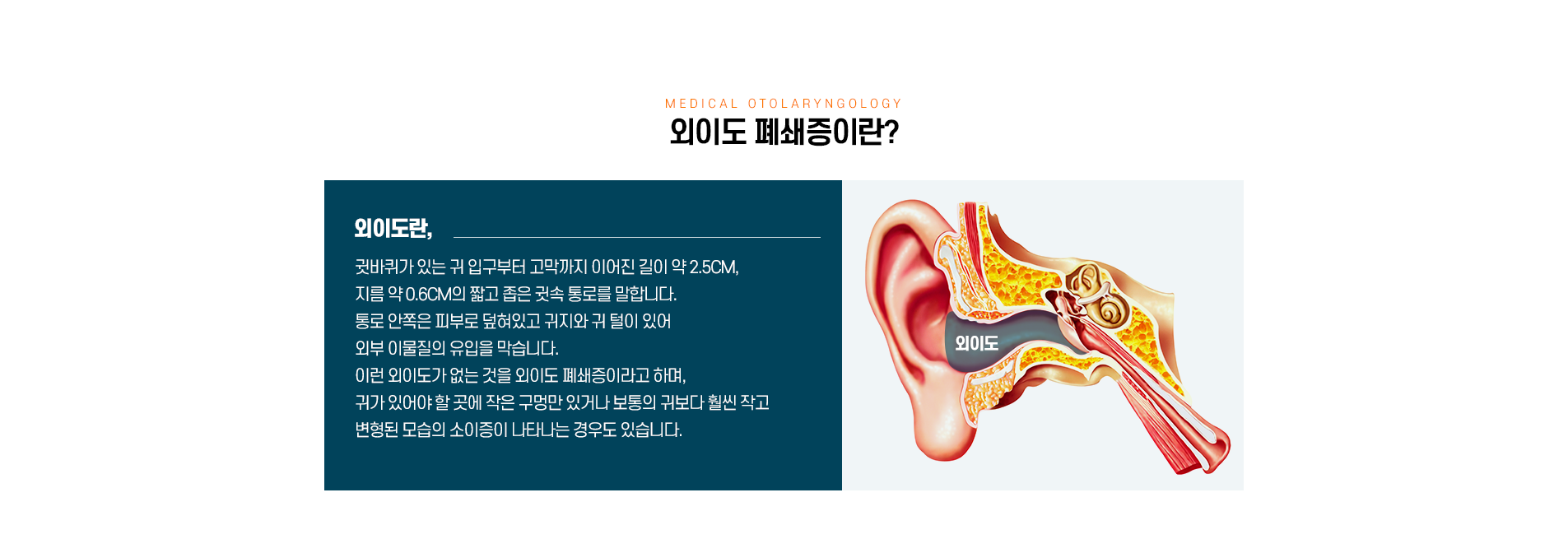 외이도폐쇄증이란