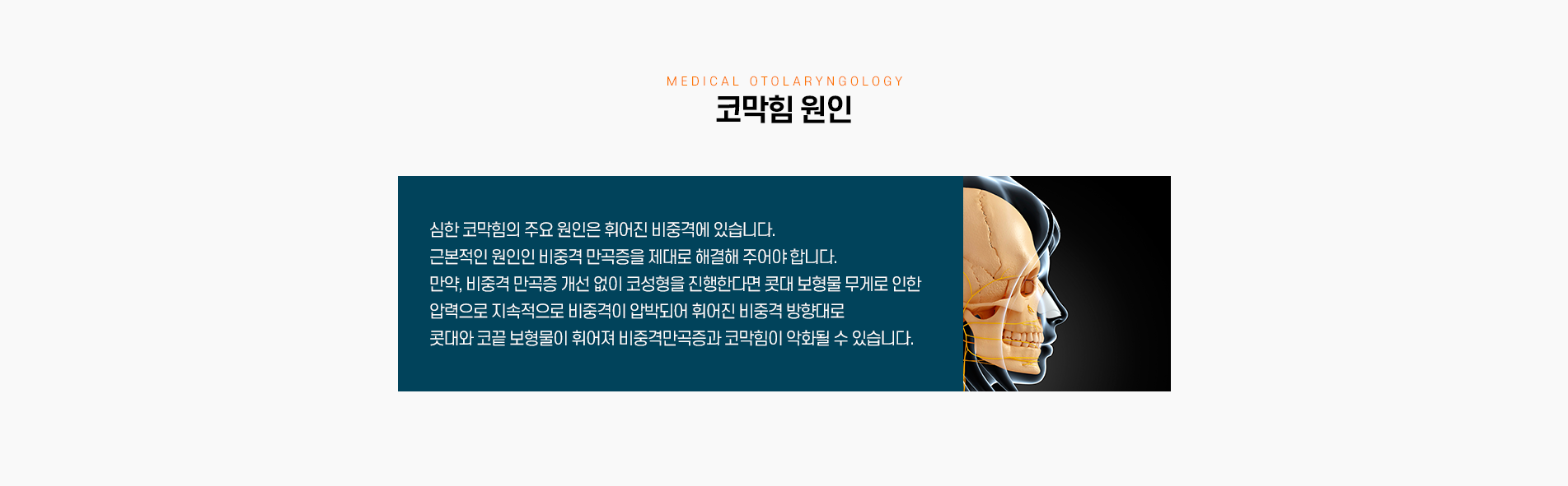 코막힘 원인