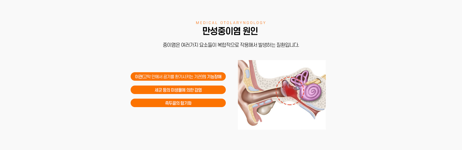 만성중이염 원인