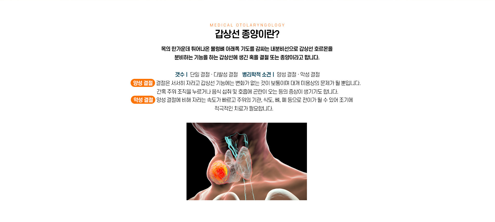 갑상선종양이란